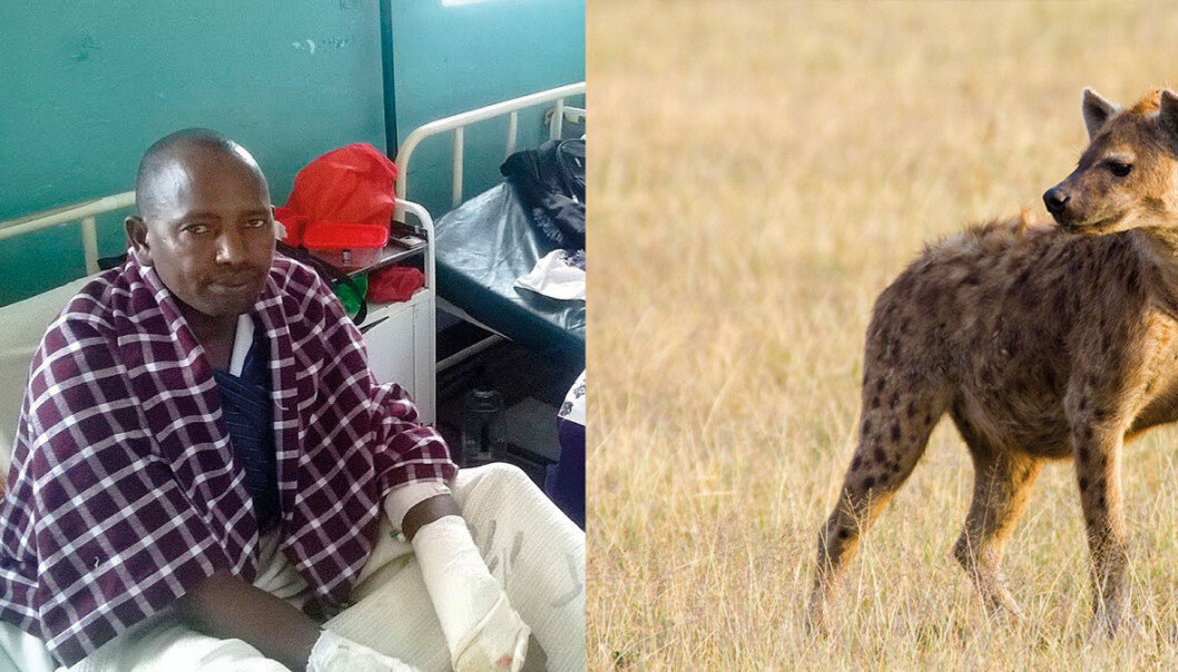 Læraren John Matipei på sjukehuset fire dagar etter hyeneåtaket. Flekkhyena er den vanlegaste av hyeneartane i Kenya. Skulderhøgda kan bli over 90 centimeter og vekta over 60 kilo, ifølgje Wikipedia. Foto: Kurgat Marindany/The Star, Mariomassone/Wikimedia Commons Læraren John Matipei på sjukehuset fire dagar etter hyeneåtaket. Flekkhyena er den vanlegaste av hyeneartane i Kenya. Skulderhøgda kan bli over 90 centimeter og vekta over 60 kilo, ifølgje Wikipedia. Foto: Kurgat Marindany/The Star, Mariomassone/Wikimedia Commons