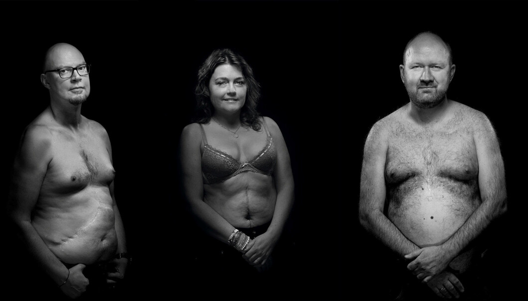 F.v: Michael Watters (44), Karianne Viken (40) og Øivind Kolloen (44) har fått nye organer, hhv. nyre og bukspyttkjertel, lever og hjerte. Foto: Tom-Egil Jensen F.v: Michael Watters (44), Karianne Viken (40) og Øivind Kolloen (44) har fått nye organer, hhv. nyre og bukspyttkjertel, lever og hjerte. Foto: Tom-Egil Jensen