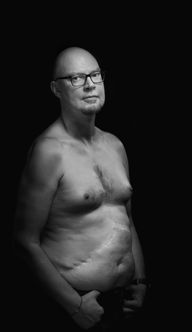 Arret nederst på siden er det eneste som vitner om den store operasjonen som ga Michael Watters anledning til å leve videre. Foto: Tom-Egil Jensen Arret nederst på siden er det eneste som vitner om den store operasjonen som ga Michael Watters anledning til å leve videre. Foto: Tom-Egil Jensen