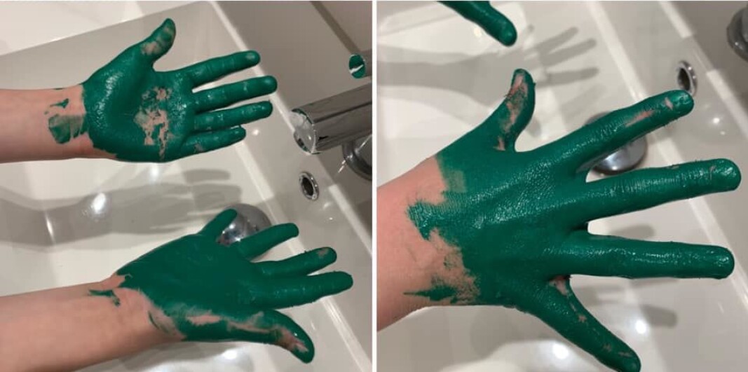 Litt mer skrubb i midten og på tommelen må til for at "såpen" skal ha vært overalt. Litt mer skrubb i midten og på tommelen må til for at "såpen" skal ha vært overalt.