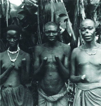 Frå Kongo. Desse fekk hendene kappa av fordi dei ikkje produserte nok råvarer for kolonimakta (Kosmos, 2007, s. 120). Frå Kongo. Desse fekk hendene kappa av fordi dei ikkje produserte nok råvarer for kolonimakta (Kosmos, 2007, s. 120).