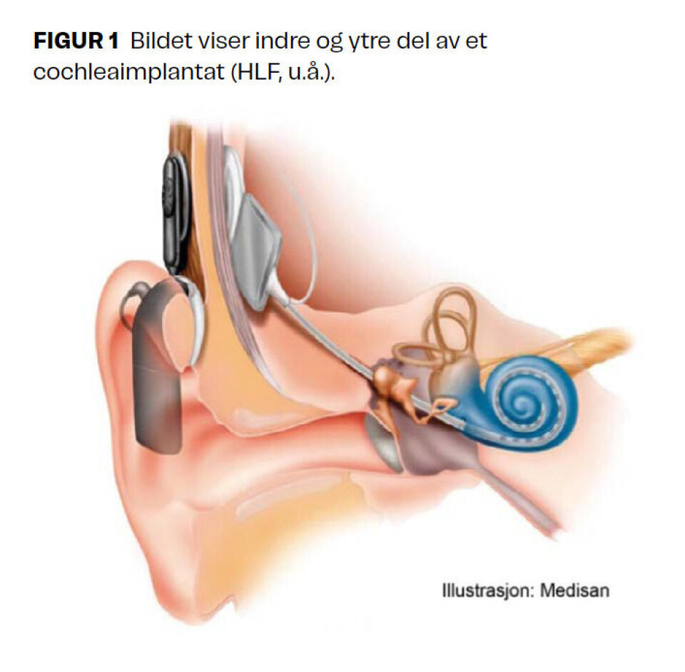 Læreres betraktninger om egen praksis og kompetanse knyttet til lytte- og taletrening for elever med cochleaimplantat